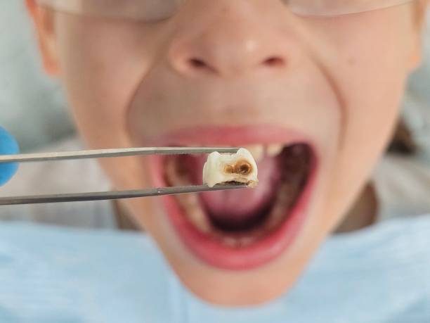 Best Emergency Treatment for Jaw Pain or Injury in Roscommon, MI